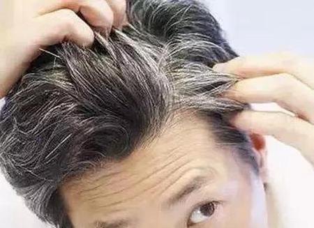 醋泡黑豆使白发变黑