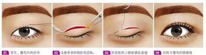 宝宝一只单眼皮一只双眼皮怎么办(宝宝一只双眼皮一只单眼皮怎么回事)